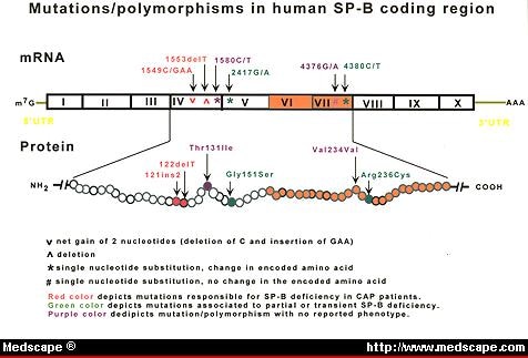 Genetic Variability Of Surfactant Protein-B And Respiratory Distress ...