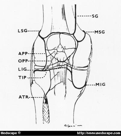 Descriptive Analysis of the Factors Associated with Patellar Fracture ...