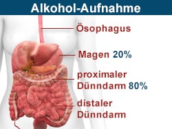 Das Alkohol-Quiz: Kennen Sie die beste Therapie bei Intoxikation?