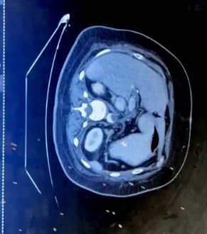 Fall Warum leidet dieser Mann an etlichen neurologischen Symptomen