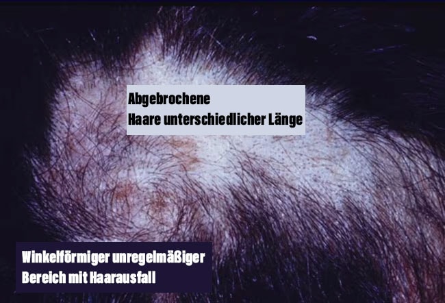 Diashow Welche Ursachen stecken hinter Haarausfall? Page 12