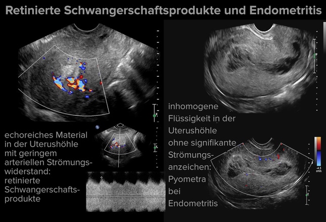 Sonografie: 10 Diagnosen, die Sie nicht übersehen sollten