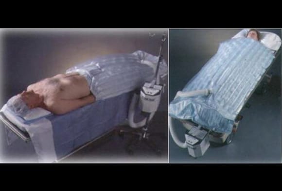 Diashow: Hypothermie  Risiken erkennen, Patienten richtig behandeln. Alle  kalten Fakten im berblick