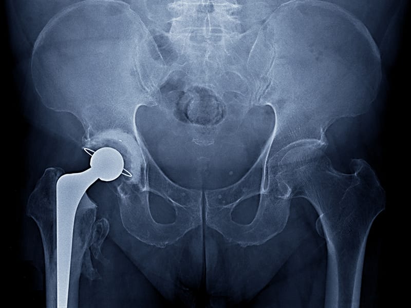 quadratische pflanztöpfe Quadratische Durchsichtige Pflanztöpfe Kaufen? ✓ Schneller Versand! –  Sybotanica main image 0