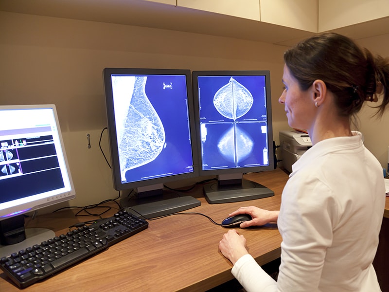 Brustkrebs-Screening: Mammografie-Intervall nach Krebsrisiko?