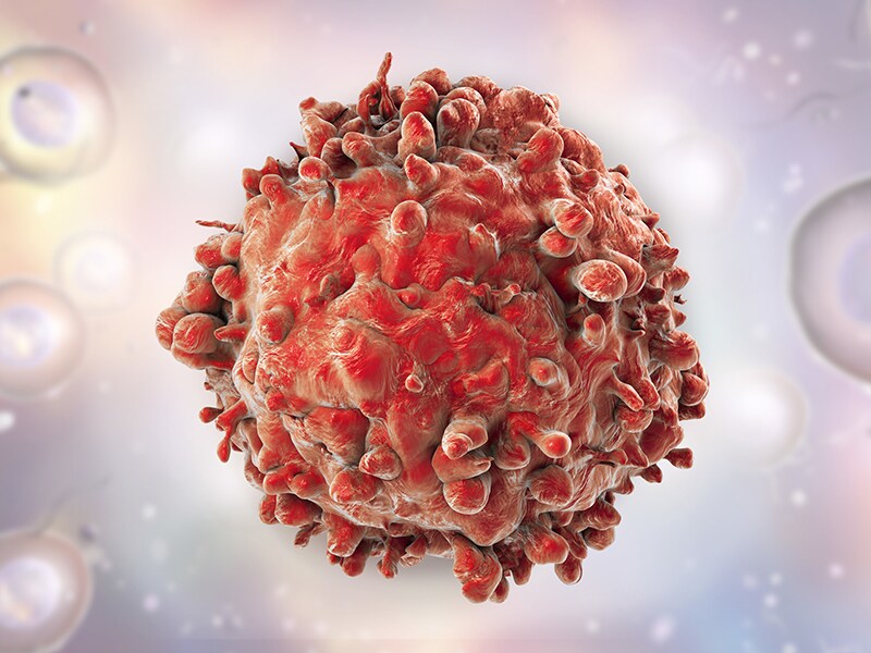 Akute lymphatische Leukämie InotuzumabOzogamicin überzeugt