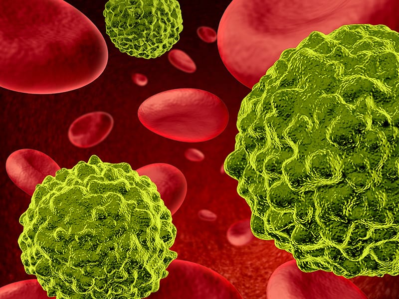 Mantelzell-Lymphom: Länger leben mit Rituximab-Erhaltungstherapie