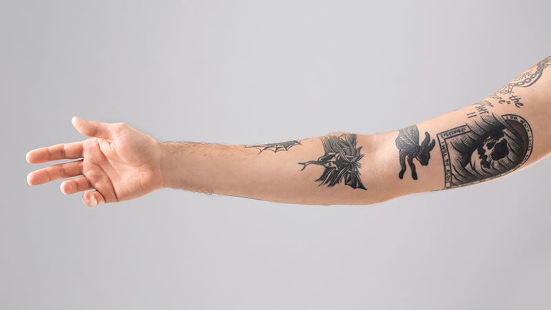 Tattoos ein Risiko im MRT?
