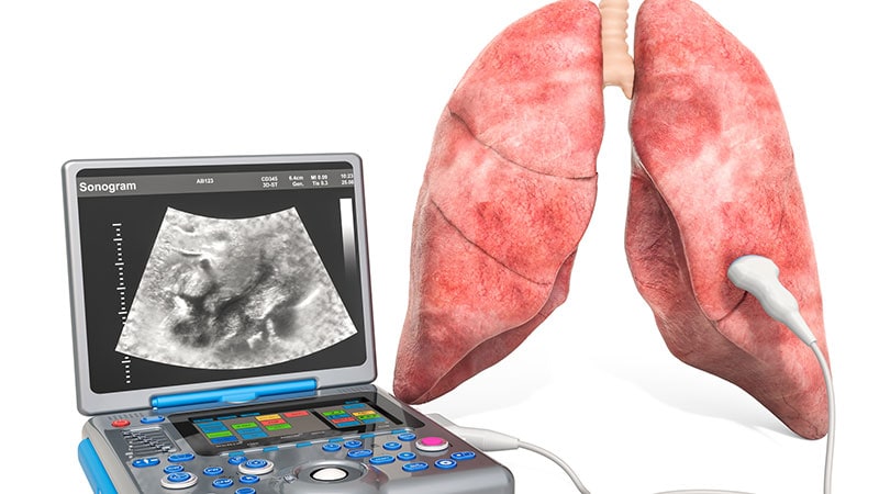 Lungenultraschall: Alternative zur Früherkennung der COVID-19-Pneumonie?