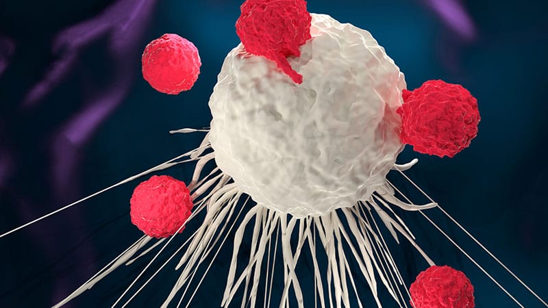 Mantelzell-Lymphom: Bessere Ansprechrate mit CAR-T-Zelltherapie
