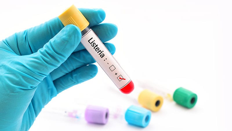 Räucherlachs als Auslöser für Listeriose-Ausbrüche in Deutschland