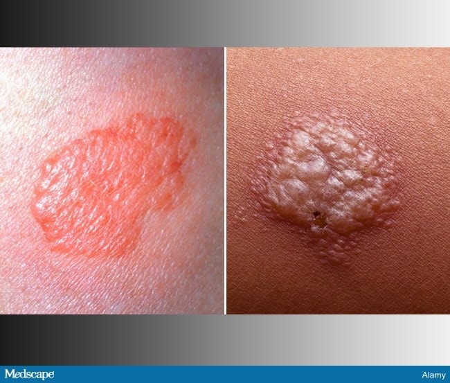 Errores diagnósticos en pacientes con síntomas pulmonares