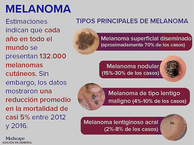 Tendencia Clínica: Melanoma