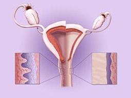 Suplementos de disfunción sexual ssri