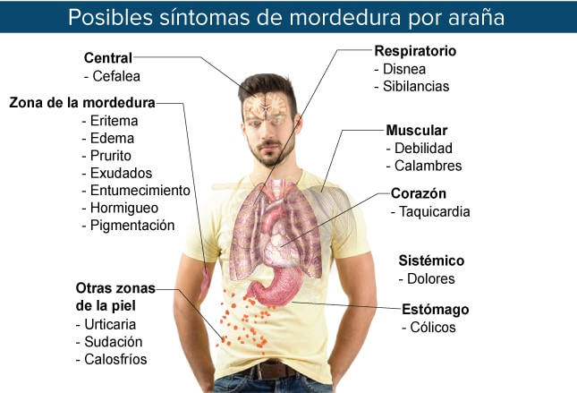 Intoxicaciones por artrópodos: desde picaduras benignas hasta ...