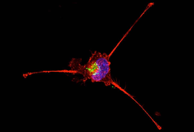 20 Impresionantes Imágenes De Células Cancerosas Mediante Microscopia Electrónica 7833