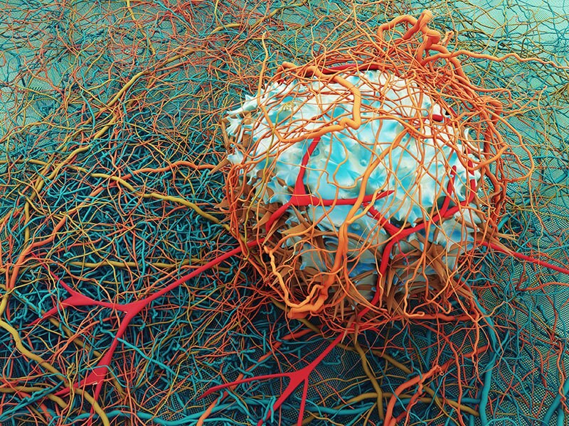 Es inmunoterapia aprobada por la FDA para el cáncer de próstata