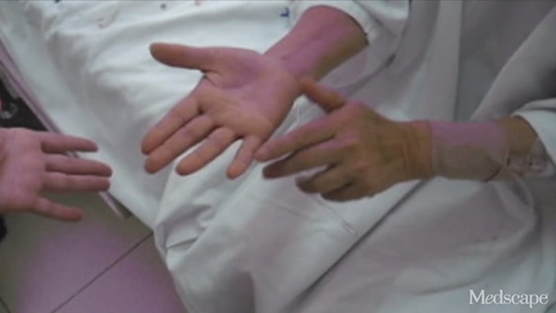 El rincón de la Neurología: Mis manos no me obedecen - Page 2