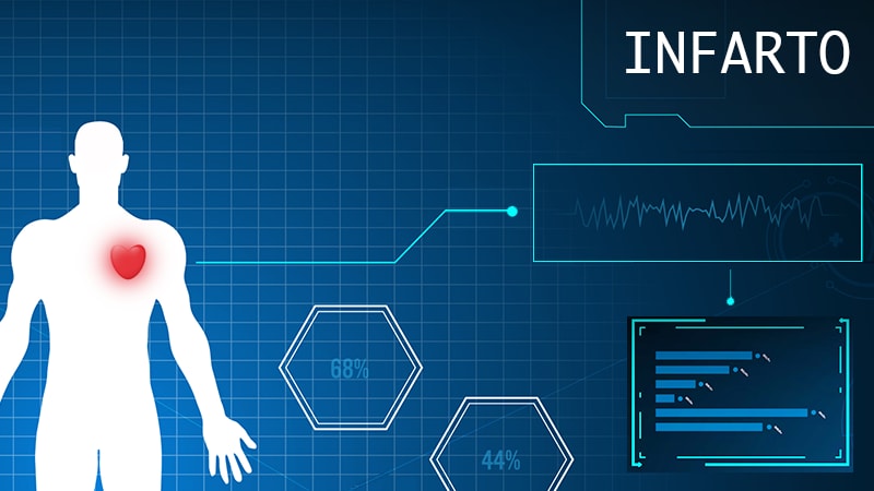 Una herramienta de inteligencia artificial predice el riesgo de infartos agudos de miocardio