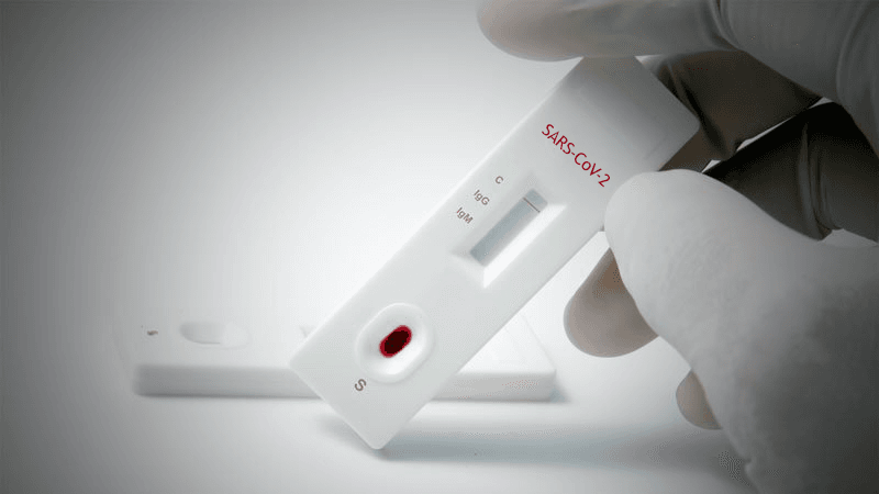 Pruebas Rapidas De Antigenos La Clave Para Frenar La Pandemia En Latinoamerica