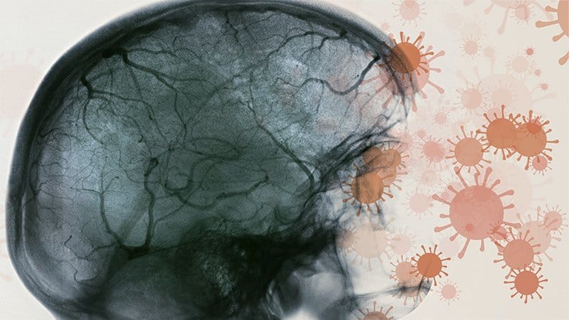COVID-19 puede dañar los vasos sanguíneos en el cerebro