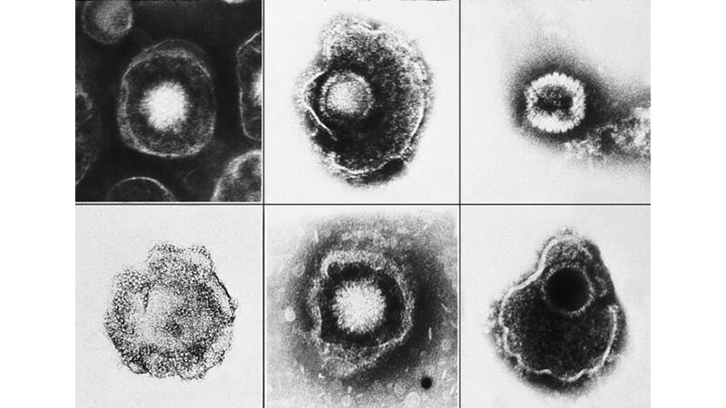 Nuevas terapias contra los virus de la familia «Herpesviridae»