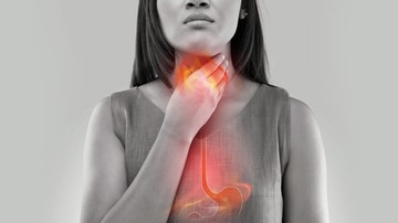 https://img.medscapestatic.com/es/thumbnail_library/dt_190913_heartburn_acid_reflux_800x450.jpg?interpolation=lanczos-none&resize=360:*