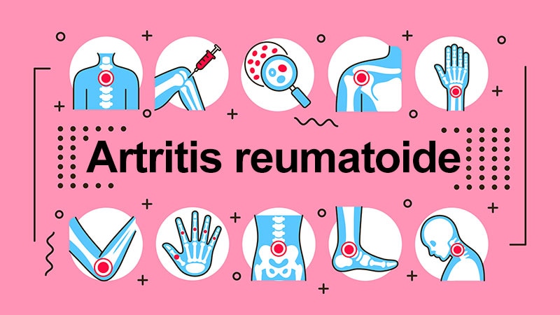 Ecos de EULAR 2021: Artritis reumatoide de difícil tratamiento: una nueva definición