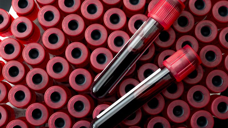 Venta De Isotretinoina