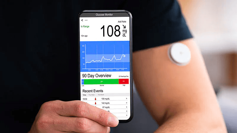 Monitoreo continuo de glucosa en la hipoglucemia posoperatoria
