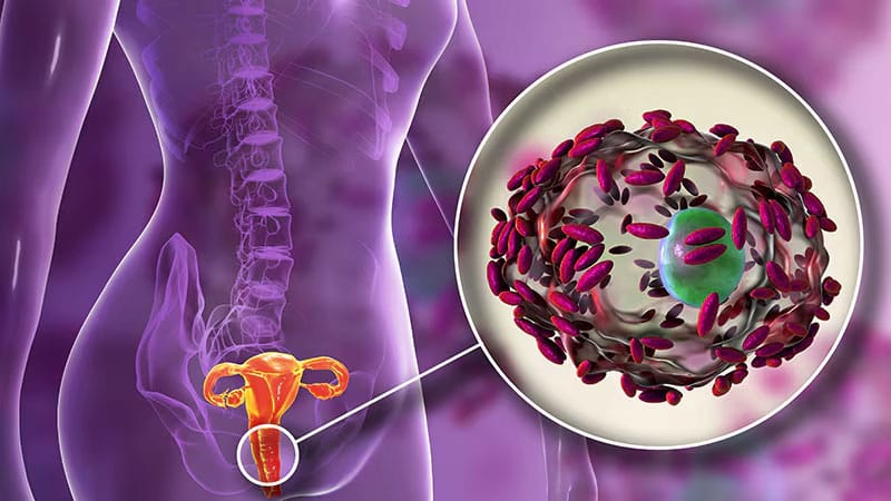 Bacterial Vaginosis Study: Transmission and Analysis - News Directory 3