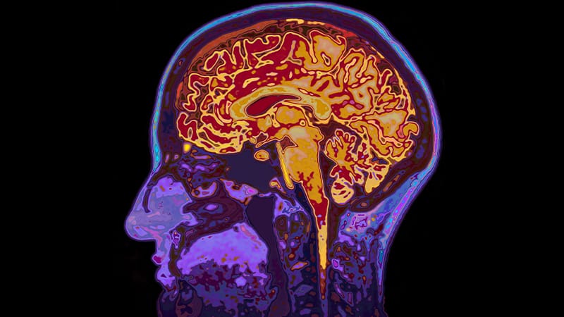 Medidas para impulsar la salud cerebral y mitigar el alto impacto de ...