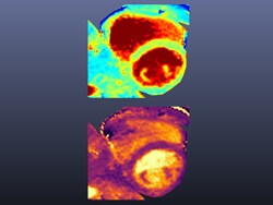 Un Nouveau Dispositif Dirm Cardiaque Capable De S