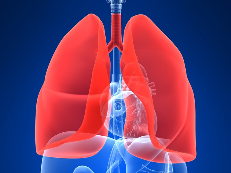Cancer du poumon : résultats sans précédent sous nivolumab
