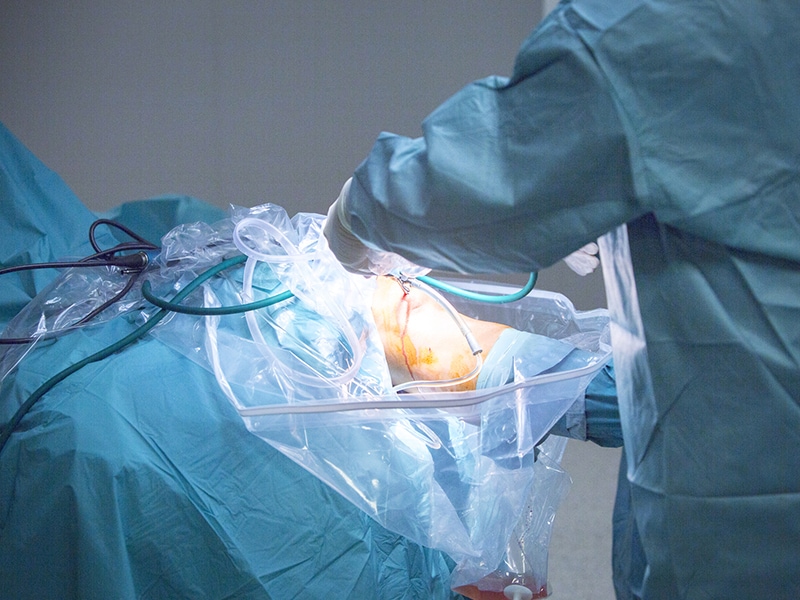 Jusqu’à quel âge un chirurgien peutil opérer ? Page 2