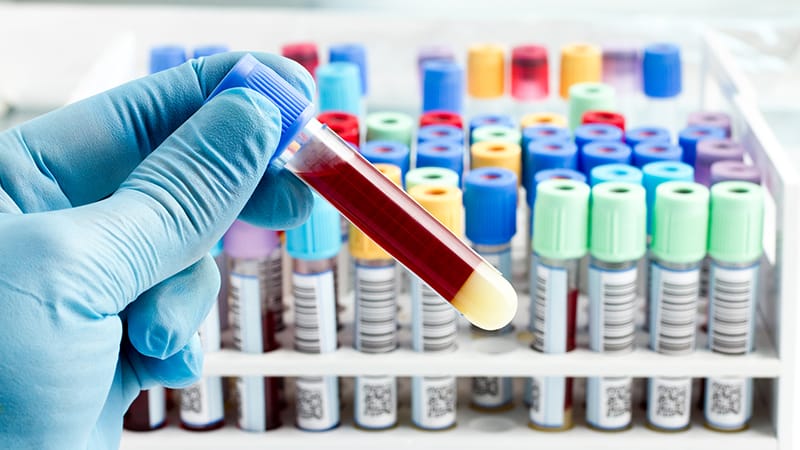 Un nouveau test sanguin pour améliorer le dépistage de l’hypertension ...