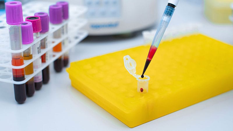 Test sanguin de dépistage des cancers : résultats encourageants mais de ...