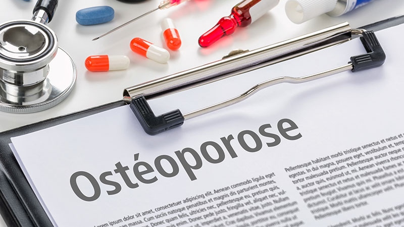 Quiz express : mythes et réalités sur l'ostéoporose