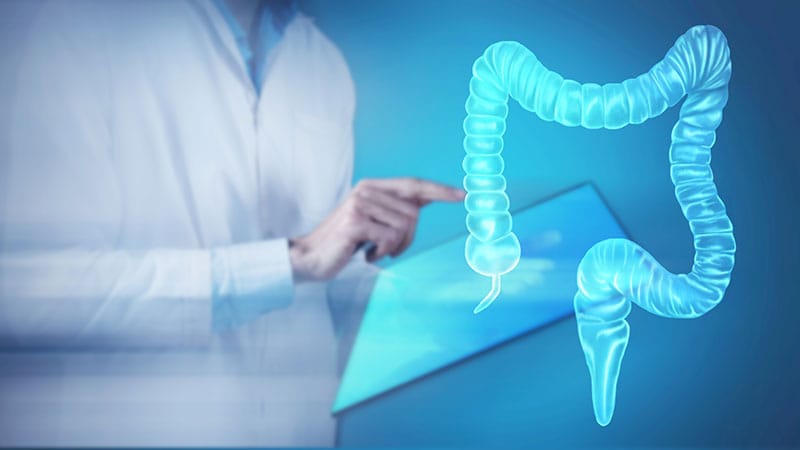 Quiz express : mythes et réalité sur la rectocolite hémorragique