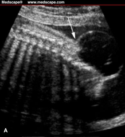 The Role of Sonography in the Evaluation of Pregnant Women