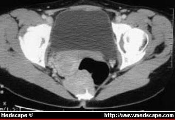 group 2019 2 exam for CT Pelvic Scan