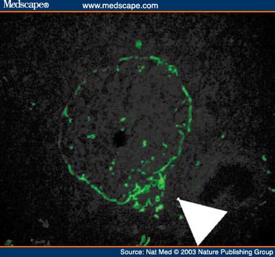 Autoimmune Islet Destruction in Spontaneous Type 1 Diabetes - Page 2