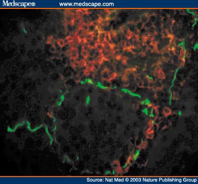 Autoimmune Islet Destruction in Spontaneous Type 1 Diabetes - Page 2