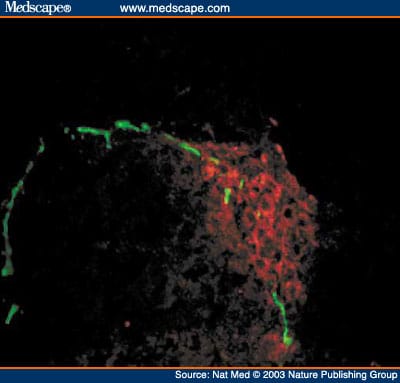 Autoimmune Islet Destruction in Spontaneous Type 1 Diabetes - Page 2