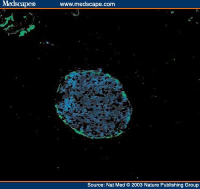 Autoimmune Islet Destruction in Spontaneous Type 1 Diabetes - Page 2