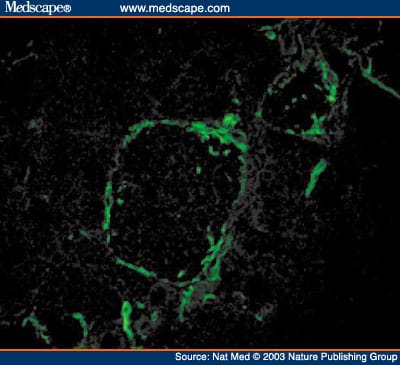 Autoimmune Islet Destruction in Spontaneous Type 1 Diabetes - Page 2