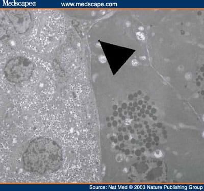 Autoimmune Islet Destruction in Spontaneous Type 1 Diabetes - Page 2