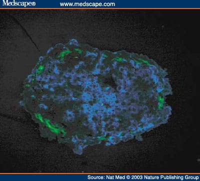 Autoimmune Islet Destruction in Spontaneous Type 1 Diabetes - Page 2