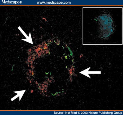 Autoimmune Islet Destruction in Spontaneous Type 1 Diabetes - Page 2