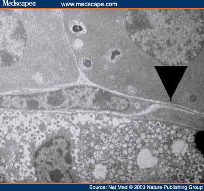 Autoimmune Islet Destruction in Spontaneous Type 1 Diabetes - Page 2